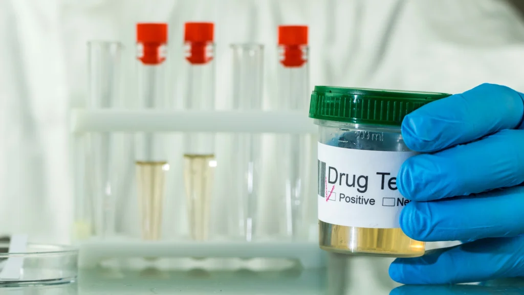 Alcohol Drug Tests: How Long Is Alcohol in Your Body?